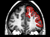 Shown in red, the frontal lobe houses the "executive system" of the brain; it decreases in volume as we age. This region helps the brain decide which tasks to focus on and when to suppress irrelevant information. (From npr.org: "The Myth of Multitasking") 