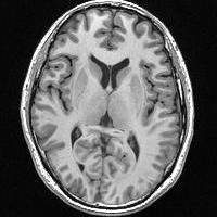 my brain