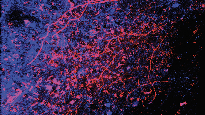 This Valentine's Day, Explore the Neuroscience of Pleasurable Touch