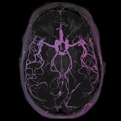Image from an MRI of the brain