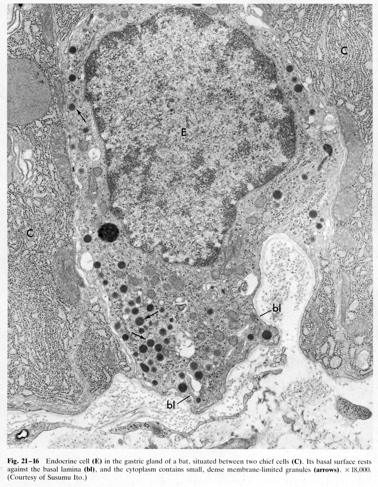 Electron Micrograph