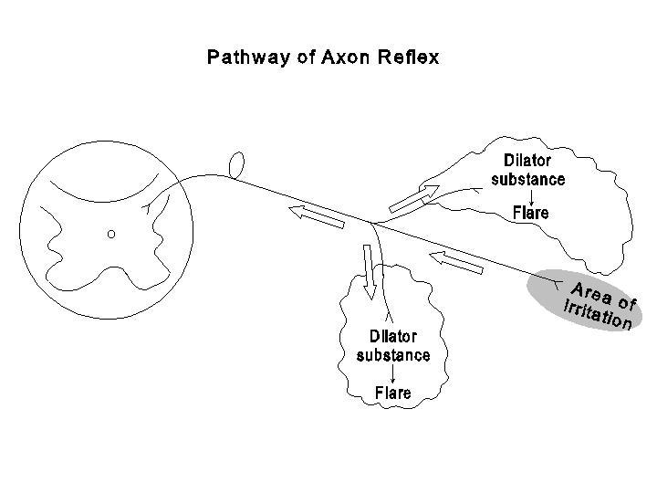 Аксон рефлекс. Аксон рефлекс схема. Аксон рефлекс рисунок. Механизм Аксон рефлекса. Аксон рефлекс физиология.